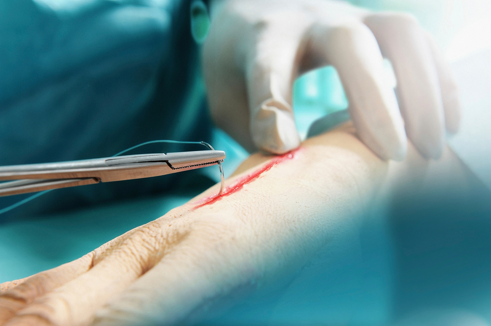 Medical professional performing surgery with precision.